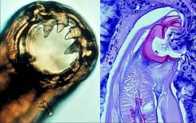 Unseen Enemies: The Secret World of Parasites